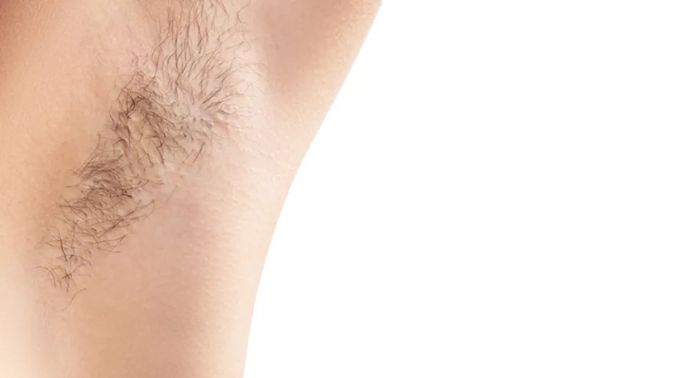 Αποτρίχωση Μασχαλών - Αποτέλεσμα 2 - Πριν